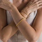 A person in a striped dress crosses their arms, embodying quiet luxury with two Bold Byzantine Bracelets in 18K Gold featuring woven links on their wrists.
